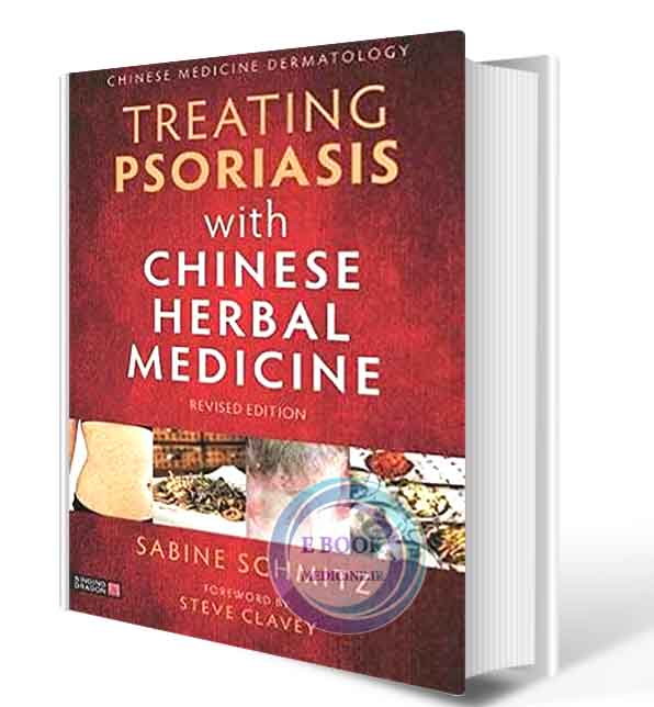 دانلود کتاب Treating Psoriasis with Chinese Herbal Medicine (Revised Edition): A Practical Handbook2021 (ORIGINAL PDF)